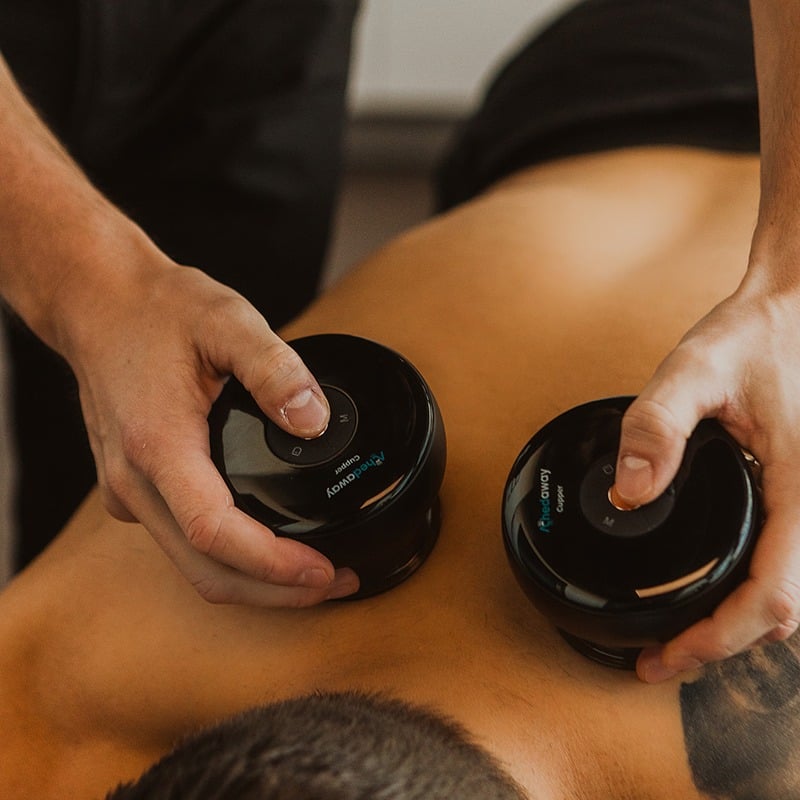 Therapist placing cupping devices on back during treatment for muscle tightness relief