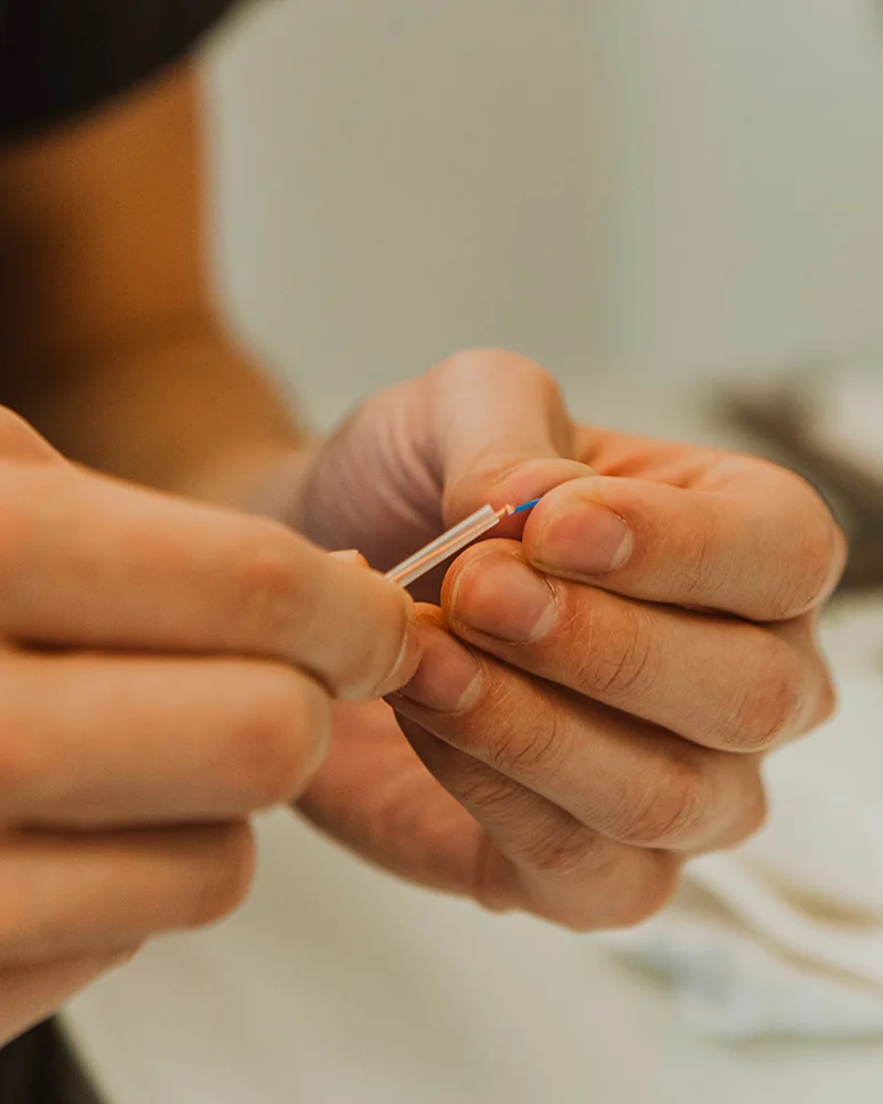 Physiotherapist preparing sterile dry needle from guide tube before trigger point treatment in Kelowna