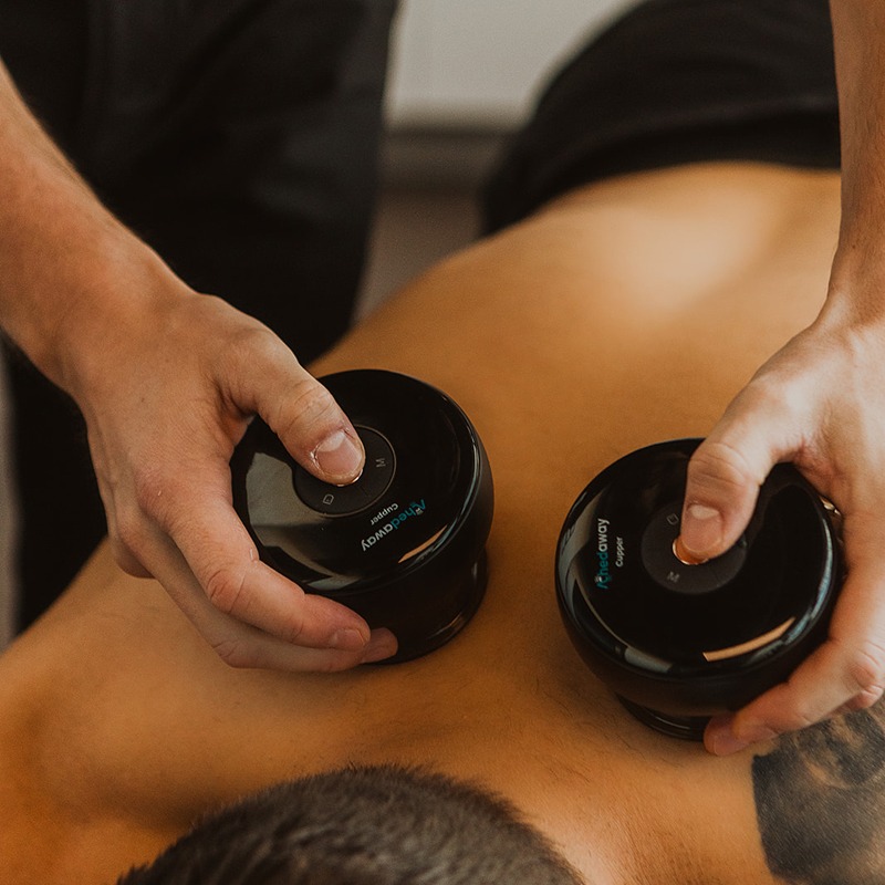 Therapist placing cupping devices on back during treatment for muscle tightness relief