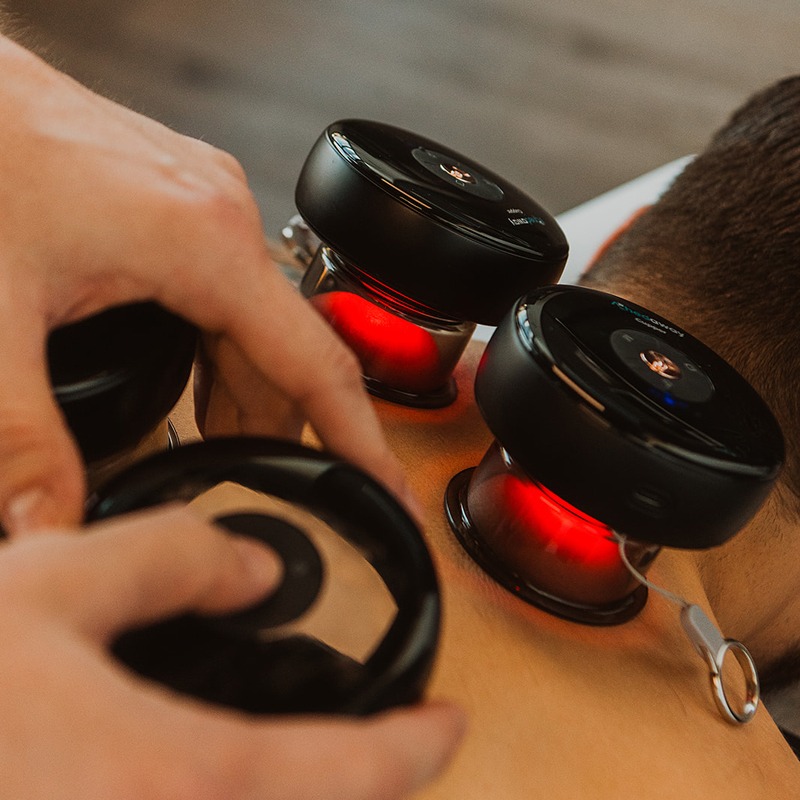 Cupping therapy with suction device applied to upper back for muscle tension relief in Kelowna